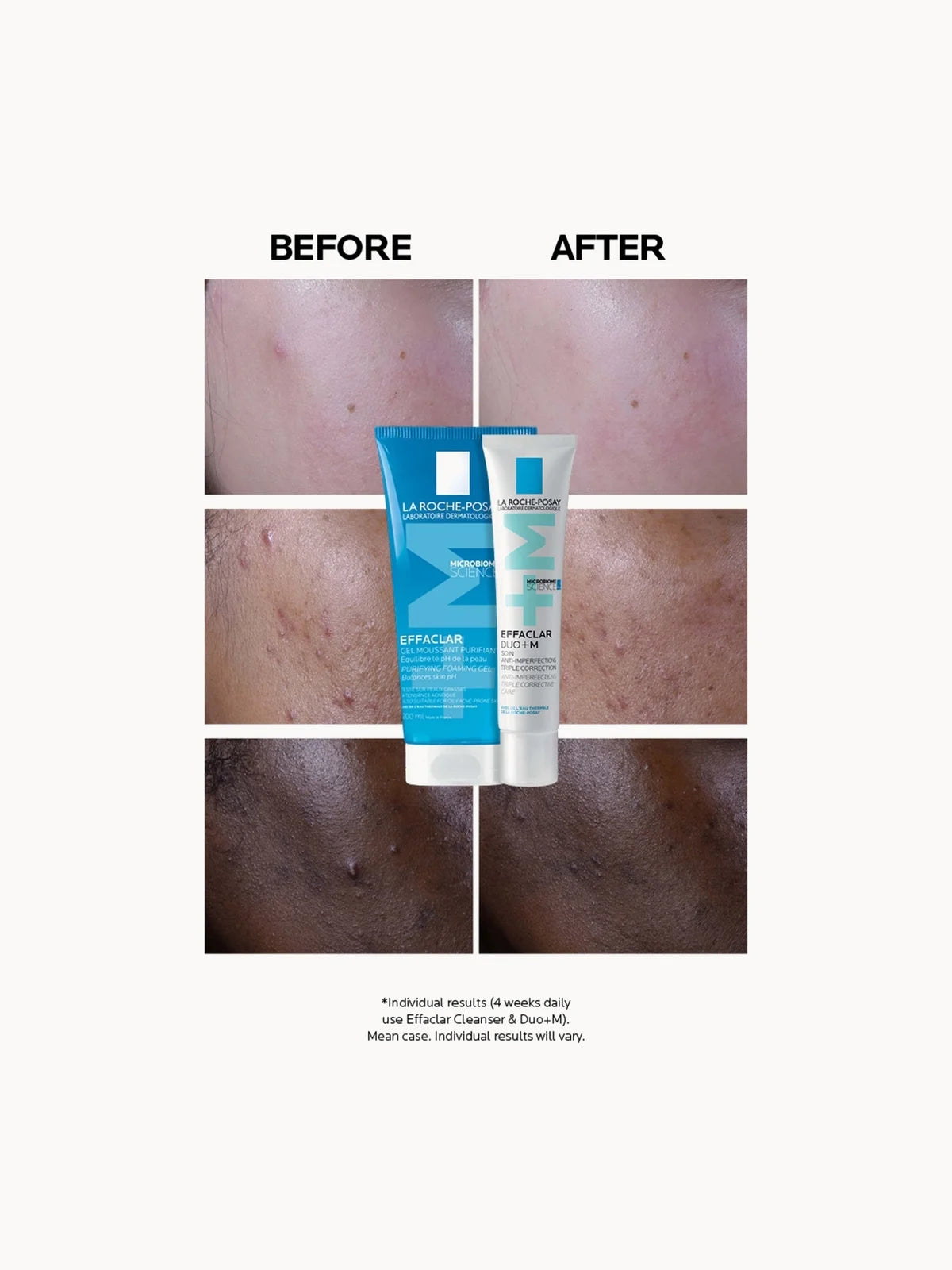 La Roche-Posay Effaclar Duo+M Anti-Blemish Corrective Gel Moisturiser for Oily, Blemish-Prone Skin 40ml