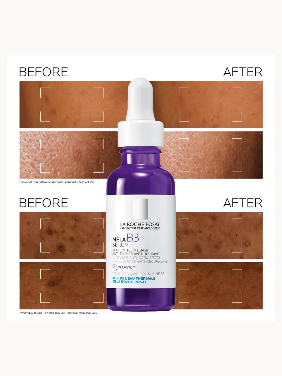 La Roche-Posay MelaB3 Serum Intense Anti-Dark Spot Serum for Hyperpigmentation 30ml