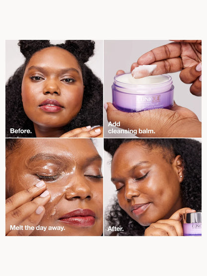Clinique Take The Day Off Cleansing Balm 125ml (Various Sizes)