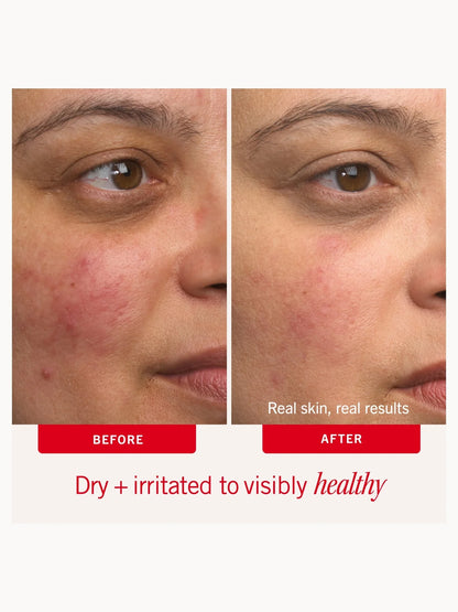First Aid Beauty Ultra Repair Cream 170g