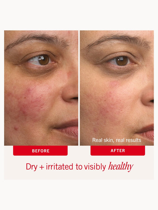 First Aid Beauty Ultra Repair Cream 170g