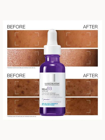 La Roche-Posay MelaB3 Serum Intense Anti-Dark Spot Serum for Hyperpigmentation 30ml