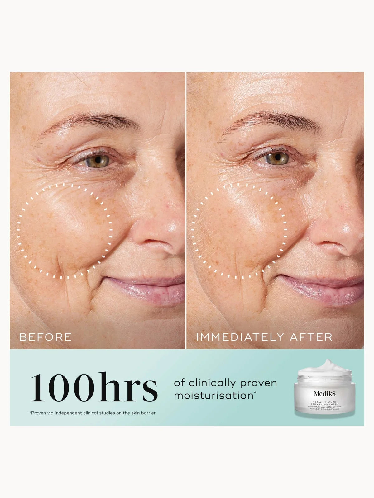 Medik8 Total Moisture Daily Facial Cream 50ml