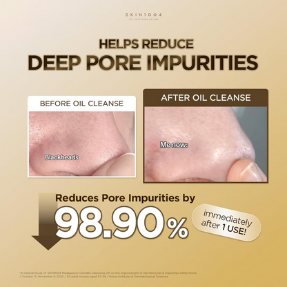 Skin1004 Madagascar Centella Light Cleansing Oil 200ml